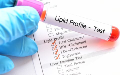 Lipid Profile Test